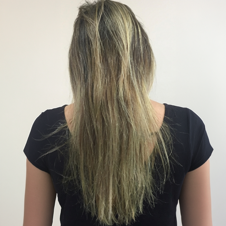 ANTES